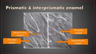 Interprismatic
enamel
Prismatic
enamel
Prismatic
enamel
Interprismatic
enamel
 