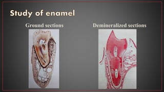 Ground sections Demineralized sections
 