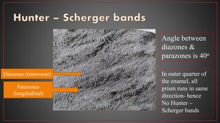 Diazones (transverse)
Parazones
(longitudinal)
Angle between
diazones &
parazones is 40o
In outer quarter of
the enamel, all
prism runs in same
direction- hence
No Hunter –
Scherger bands
 