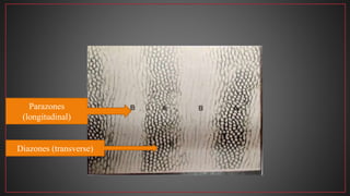 Diazones (transverse)
Parazones
(longitudinal)
 