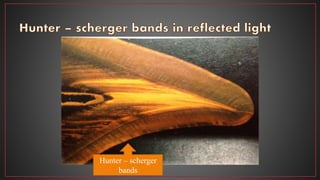 Hunter – scherger
bands
 