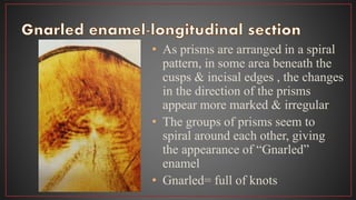 • As prisms are arranged in a spiral
pattern, in some area beneath the
cusps & incisal edges , the changes
in the direction of the prisms
appear more marked & irregular
• The groups of prisms seem to
spiral around each other, giving
the appearance of “Gnarled”
enamel
• Gnarled= full of knots
 