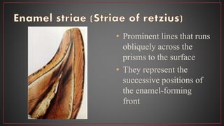 • Prominent lines that runs
obliquely across the
prisms to the surface
• They represent the
successive positions of
the enamel-forming
front
 