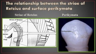Striae of Retzius Perikymata
 