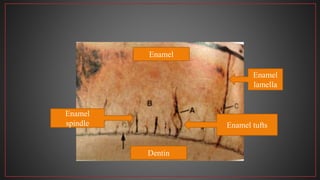 Enamel
Dentin
Enamel tufts
Enamel
lamella
Enamel
spindle
 
