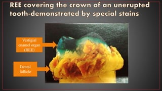 Dental
follicle
Vestigial
enamel organ
(REE)
 