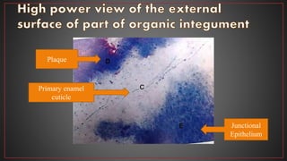Plaque
Primary enamel
cuticle
Junctional
Epithelium
 