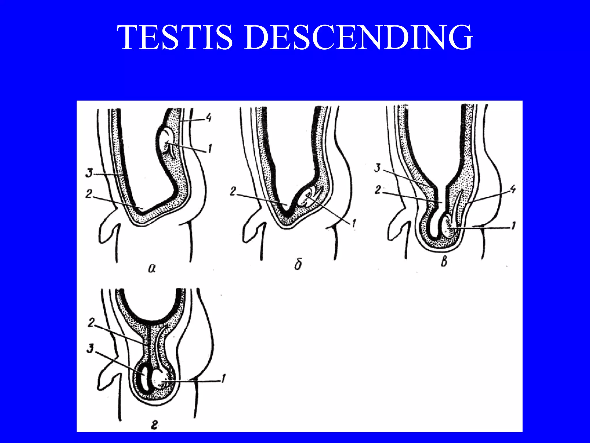 TESTIS DESCENDING 
