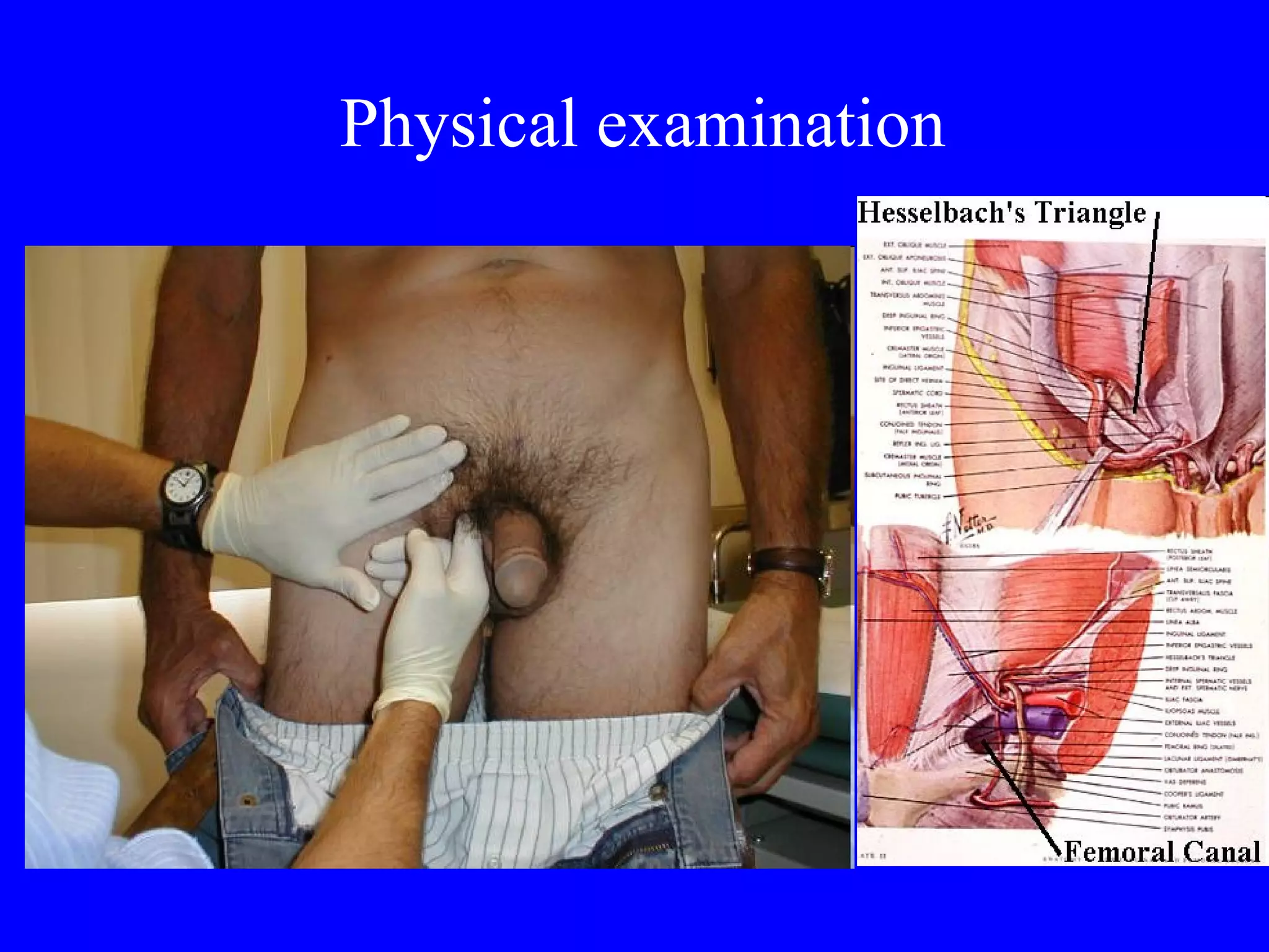 Physical examination 