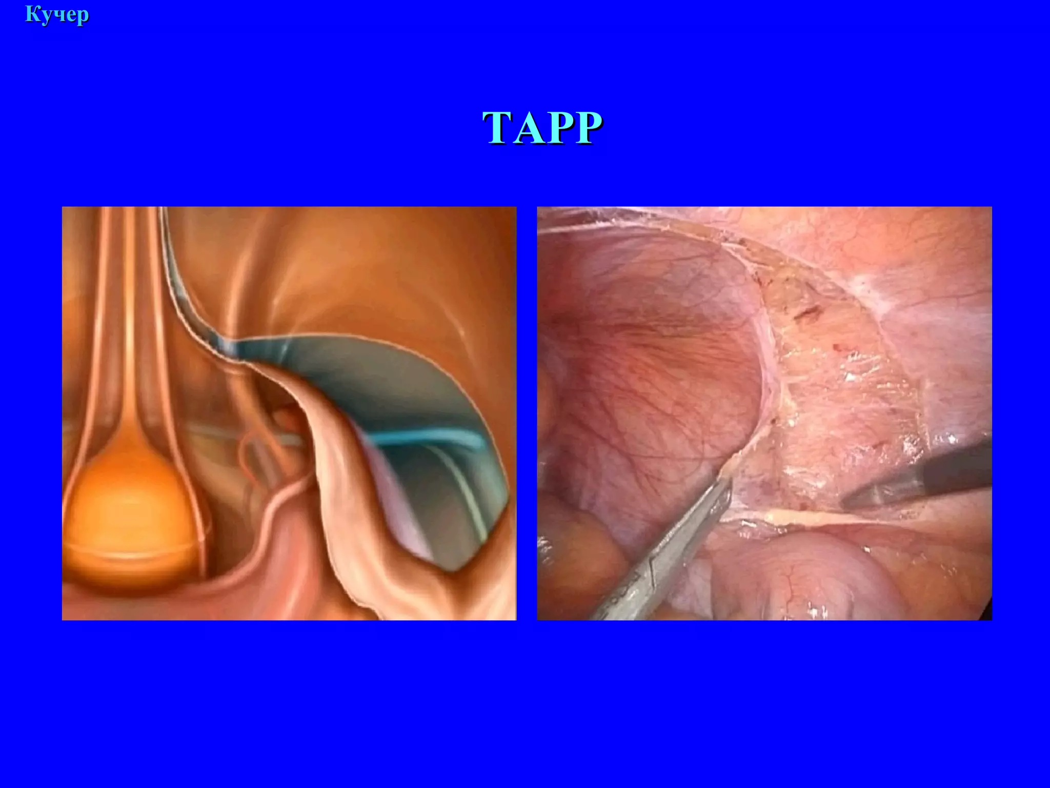 М. Кучер ТАРР 