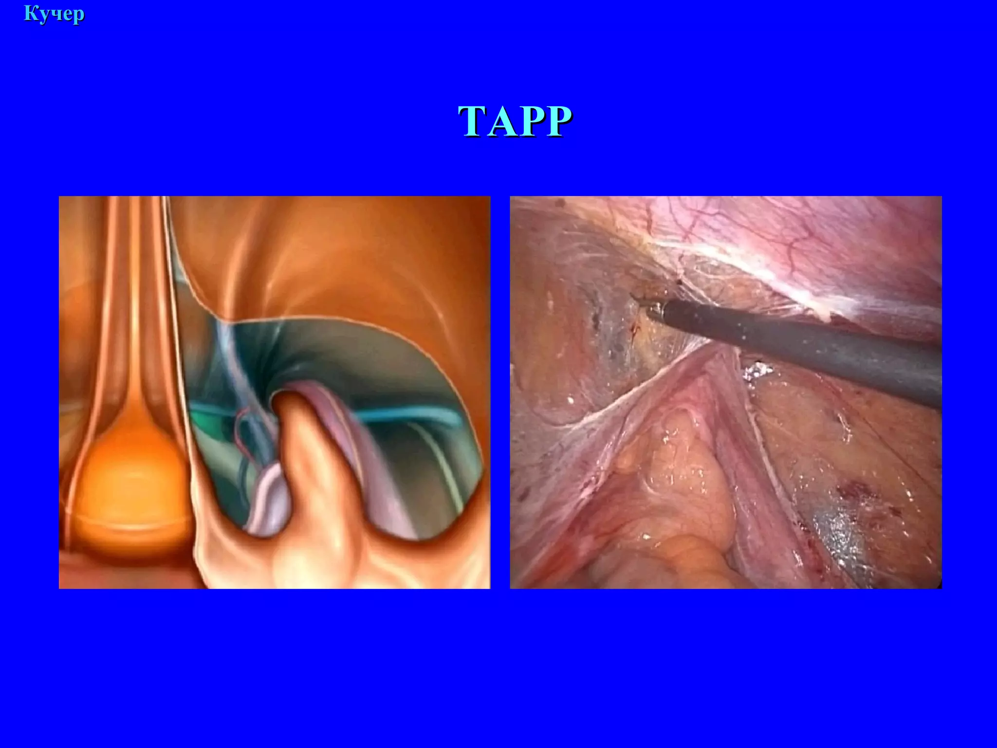 М. Кучер ТАРР 