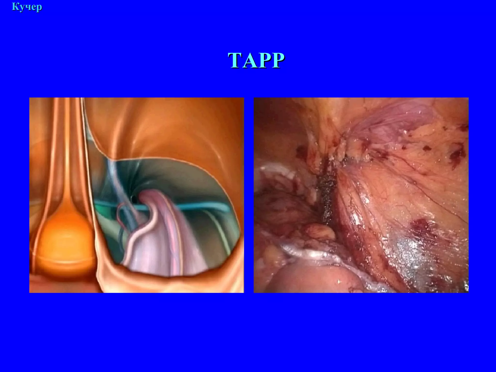 М. Кучер ТАРР 