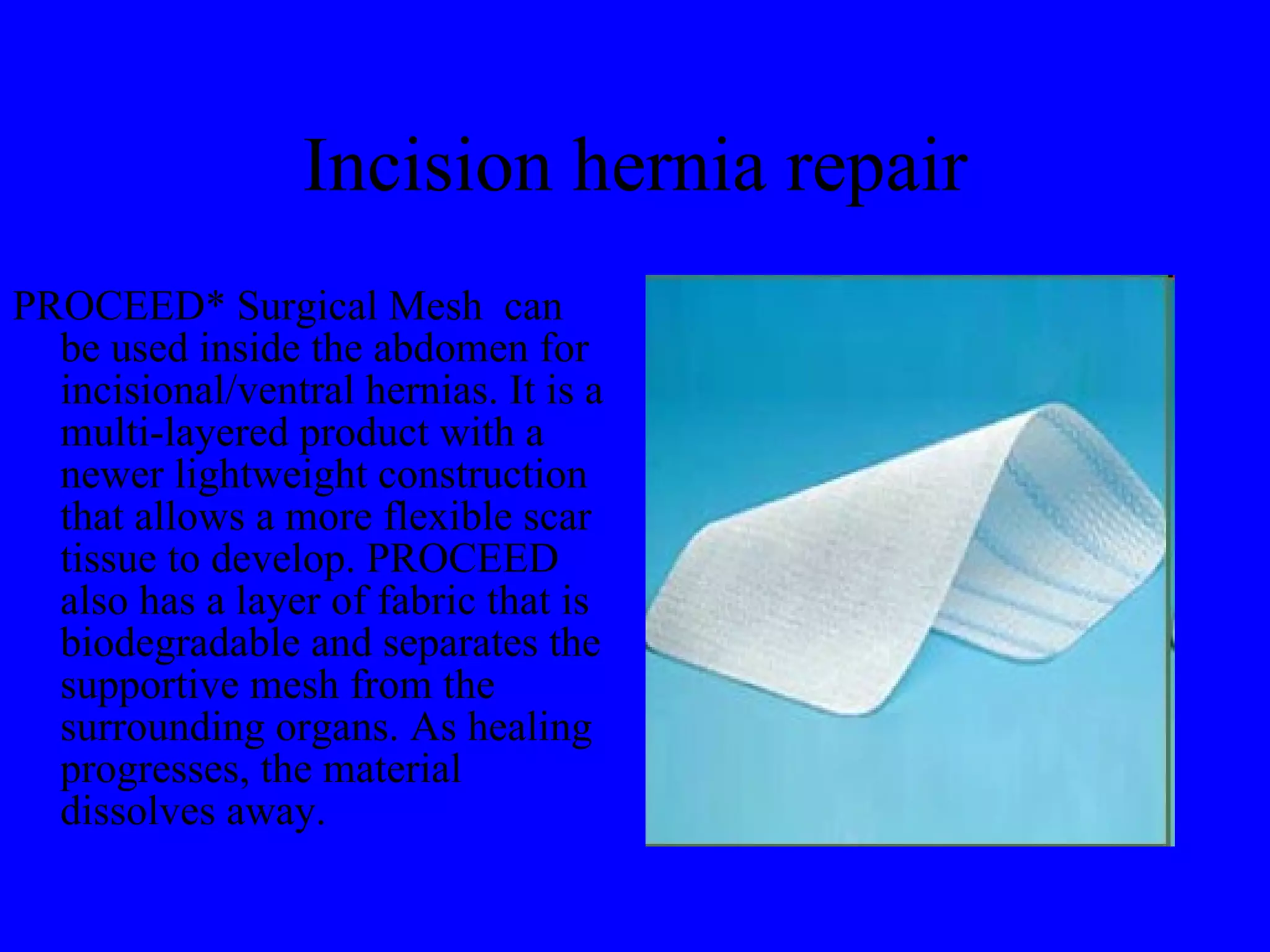 Incision hernia repair PROCEED* Surgical Mesh  can be used inside the abdomen for incisional/ventral hernias. It is a multi-layered product with a newer lightweight construction that allows a more flexible scar tissue to develop. PROCEED also has a layer of fabric that is biodegradable and separates the supportive mesh from the surrounding organs. As healing progresses, the material dissolves away. 