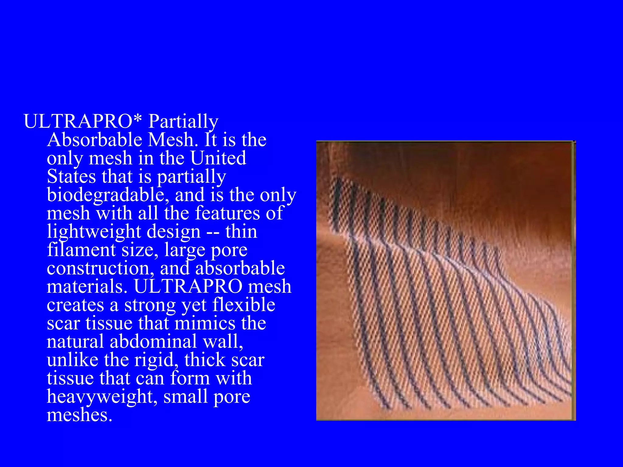 ULTRAPRO* Partially Absorbable Mesh. It is the only mesh in the United States that is partially biodegradable, and is the only mesh with all the features of lightweight design -- thin filament size, large pore construction, and absorbable materials. ULTRAPRO mesh creates a strong yet flexible scar tissue that mimics the natural abdominal wall, unlike the rigid, thick scar tissue that can form with heavyweight, small pore meshes. 