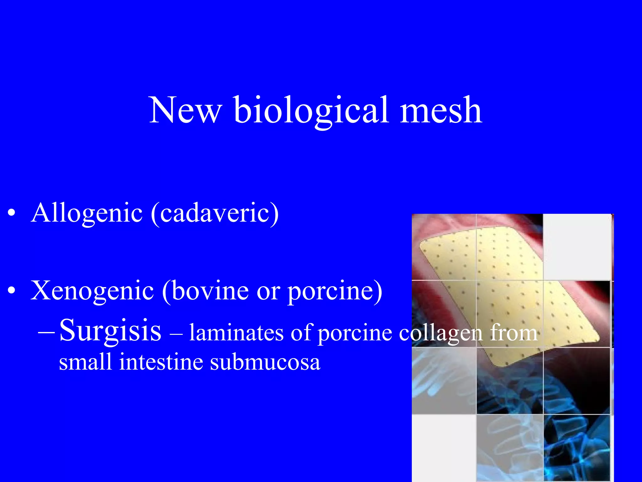 New biological mesh Allogenic (cadaveric) Xenogenic (bovine or porcine) Surgisis  – laminates of porcine collagen from small intestine submucosa 