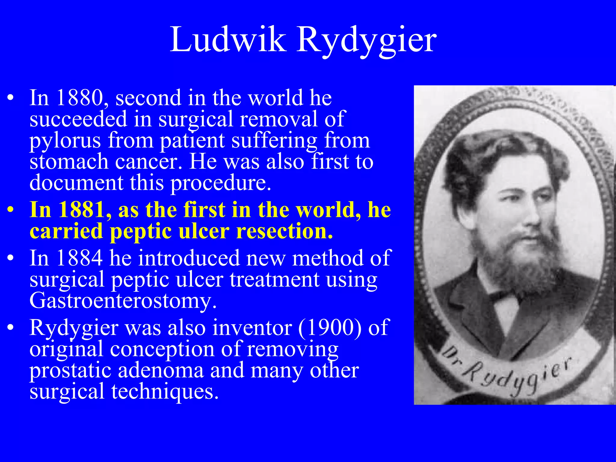 Ludwik Rydygier In 1880, second in the world he succeeded in surgical removal of pylorus from patient suffering from stomach cancer. He was also first to document this procedure.  In 1881, as the first in the world, he carried peptic ulcer resection.  In 1884 he introduced new method of surgical peptic ulcer treatment using Gastroenterostomy. Rydygier was also inventor (1900) of original conception of removing prostatic adenoma and many other surgical techniques. 