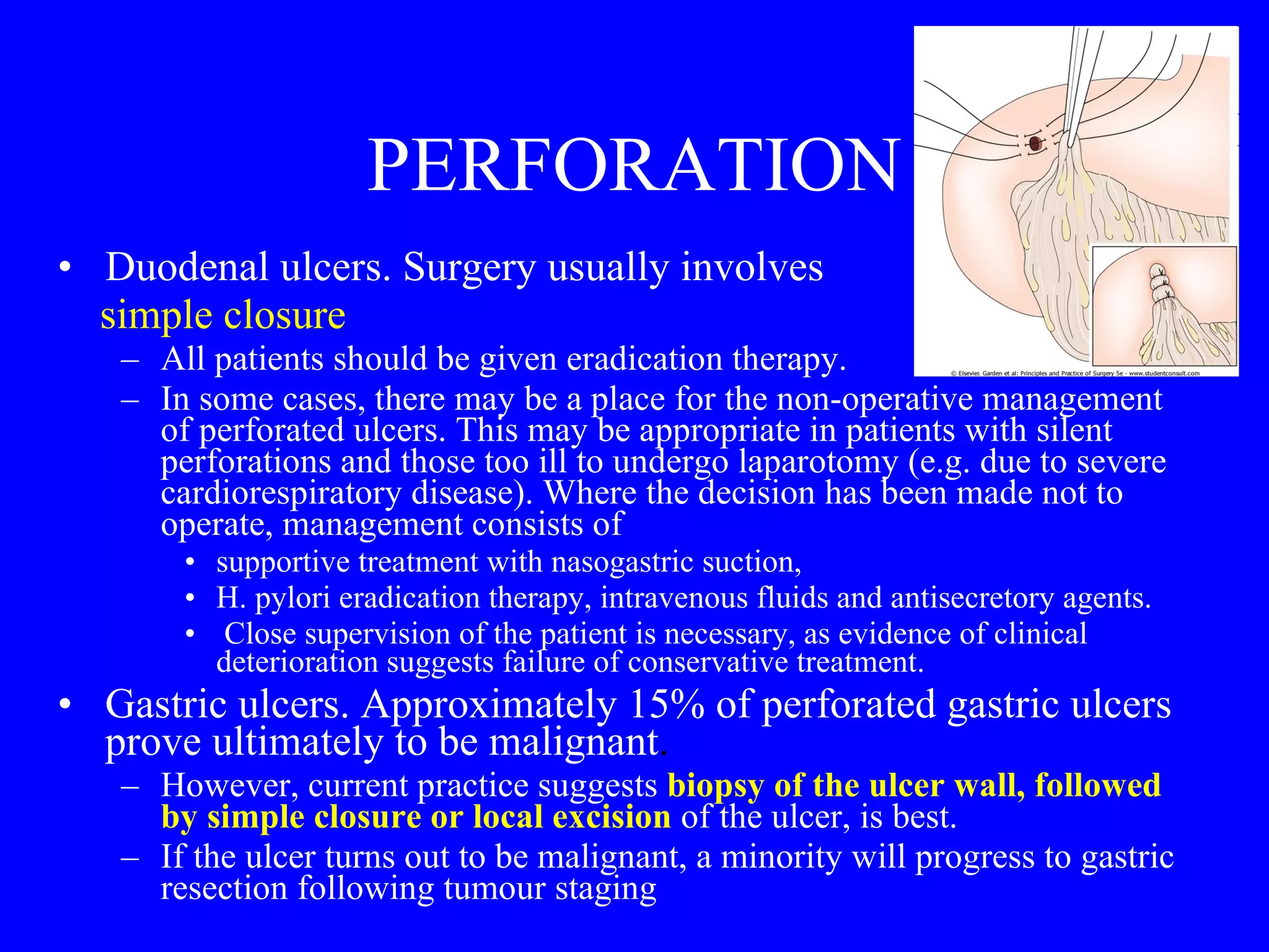 PERFORATION Duodenal ulcers. Surgery usually involves  simple closure All patients should be given eradication therapy.  In some cases, there may be a place for the non-operative management of perforated ulcers. This may be appropriate in patients with silent perforations and those too ill to undergo laparotomy (e.g. due to severe cardiorespiratory disease). Where the decision has been made not to operate, management consists of  supportive treatment with nasogastric suction,  H. pylori eradication therapy, intravenous fluids and antisecretory agents. Close supervision of the patient is necessary, as evidence of clinical deterioration suggests failure of conservative treatment. Gastric ulcers. Approximately 15% of perforated gastric ulcers prove ultimately to be malignant .  However, current practice suggests   biopsy of the ulcer wall, followed by simple closure or local excision   of the ulcer, is best.  If the ulcer turns out to be malignant, a minority will progress to gastric resection following tumour staging 
