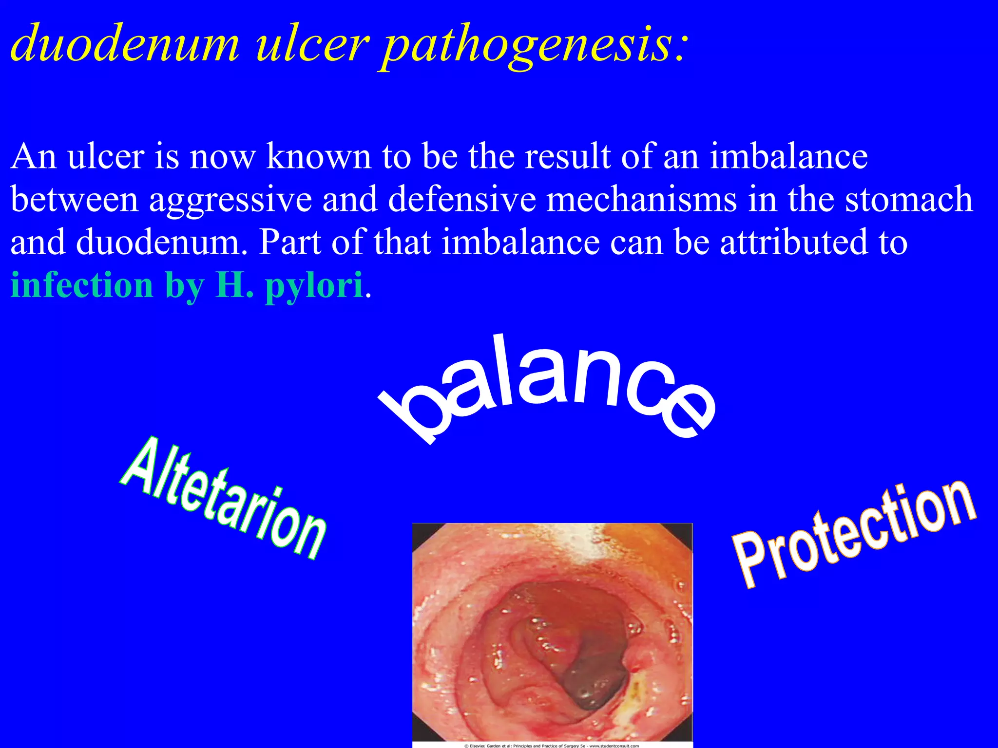 duodenum ulcer pathogenesis:   An ulcer is now known to be the result of an imbalance between aggressive and defensive mechanisms in the stomach and duodenum. Part of that imbalance can be attributed to  infection by H. pylori . Altetarion Protection balance 