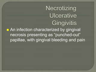  An infection characterized by gingival
necrosis presenting as “punched-out”
papillae, with gingival bleeding and pain
 
