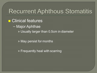  Clinical features
– Major Aphthae
» Usually larger than 0.5cm in diameter
» May persist for months
» Frequently heal with scarring
 