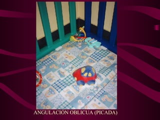ANGULACIÓN OBLICUA (PICADA) 