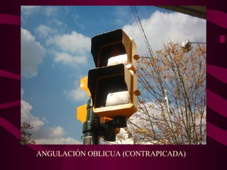 ANGULACIÓN OBLICUA (CONTRAPICADA) 