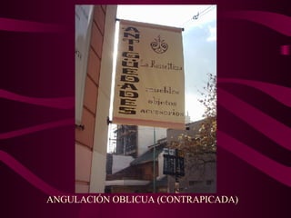 ANGULACIÓN OBLICUA (CONTRAPICADA) 