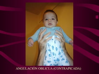 ANGULACIÓN OBLICUA (CONTRAPICADA) 
