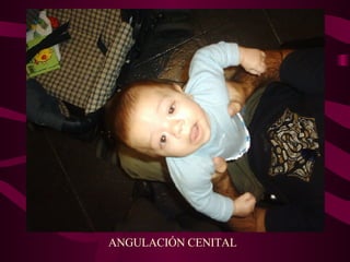 ANGULACIÓN CENITAL 
