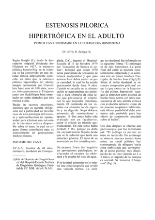 ESTENOSIS PILORICA
HIPERTRÓFICA EN EL ADULTO
PRIMER CASO INFORMADO EN LA LITERATURA HONDURENA
Dr. Silvio R. Zúniga (1)
Según Knight (1), desde la des-
cripción original efectuada por
Hildanus en 1627, la estenosis
pilórica hipertrófica en la infan-
cia se ha convertido en una en-
tidad clínica ampliamente cono-
cida, en tanto que la estenosis
pilórica hipertrófica del adulto,
aunque reconocida por Cruveil-
heir hace más de 100 años, ocu-
rre infrecuentemente y Cirujanos
junto con Radiólogos bien entre-
nados no están alertados que esta
entidad existe.
Dadas las razones anteriores,
creemos que es nuestra obliga-
ción dar a publicidad un reciente
caso de esta patología infrecuen-
te y aprovecharemos tal oportu-
nidad para efectuar una revisión
de la literatura médica disponi-
ble sobre el tema, lo cual en al-
guna forma contribuirá para el
conocimiento de generaciones
médicas futuras.
INFORME DEL CASO
S.F.A.A., hombre de 48 años,
carnicero, residente en Comaya-
(i)Jefe del Servicio de Cirugía Gene-
ral del Hospital-Escuela Profesor
de Diagnóstico Quirúrgico, Facul-
tad de CC. MM. de la U.N.A.H.
giiela, D.C., ingresó al Hospital-
Escuela el 11 de Octubre 1979
por "sensación de llenura al co-
mer". Informó que desde 1970
venía padeciendo de sensación de
llenura postprandiaí y que para
sentirse bien debía comer en po-
ca cantidad, lo cual lo ha estado
practicando desde hace 9 años.
Cuando se excedía en su alimen-
tación se acrecentaban sus moles-
tias y para liberarse de ellas te-
nía que provocarse el vómito,
con lo que mejoraba inmediata-
mente. El contenido de los vó-
mitos era alimento recién ingeri-
do y no digerido. Negó dolores,
presencia de tumoraciones o
agruras. 15 días antes había sido
evaluado por un facultativo,
quien le ordenó un tránsito gas-
troduodenal. En este lapso había
perdido 6 Ibs. porque su dieta
era exclusivamente líquida desde
que se le informó que tenía una
estrechez pilórica. El resto de su
anamnesis no fue contribuyente.
Su examen físico fue' negativo
en aportaciones patológicas, in-
cluyendo el examen de abdo-
men y la prueba del vaso de agua.
P re hospital ariamente se le orde-
nó una colecistografia que reveló
una vesícula normal. La serie
gas tro duodenal fue informada en
la siguiente forma: "El estómago
es de tipo hipotónico. La parte
final del antro se muestra cons-
tantemente estrechada y se conti-
núa con un píloro también fino,
rígido, de bordes lisos (Fig.ly2).
Sobre el bulbo duodenal se re-
conoce compresión próxima! co-
mo la que existe en la hipertro-
fia del píloro. Impresión: Aun-
que la estrechez antro-pilórica de
bordes lisos podría ser tanto con-
secuencia de una antritis crónica
con evolución retráctil, como de
un proceso neoplásico infiltrante,
esta última posibilidad debe esti-
marse más probable pues hay
efecto de compresión asociado
sobre el bulbo".
Dos días después se efectuó una
gastroscopía, que fue informada
así: "El esófago es normal en
todo su recorrido. En estómago
se observa mucosa normal hasta
antro, en canal pilórico hay
convergencia de pliegues hacia
zona umbilicada que correspon-
de al anillo pilórico muy dismi-
nuido de calibre (lumen de 2 a
3 mm.); el aspecto de la mucosa
es normal. Se tomaron 3 biop-
sias" (Fig. 3).
 