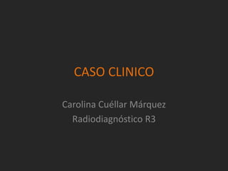 CASO CLINICO 
Carolina Cuéllar Márquez 
Radiodiagnóstico R3 
 