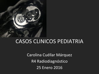 CASOS CLINICOS PEDIATRIA
Carolina Cuéllar Márquez
R4 Radiodiagnóstico
25 Enero 2016
 