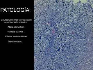 PATOLOGÍA:
Células fusiformes y ovoladas de
aspecto miofibroblástico.
Atipia citonuclear.
Núcleos bizarros .
Células multinucleadas.
Índice mitótico.
 