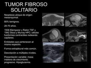 TUMOR FIBROSO
SOLITARIO
Neoplasia ubiqua de origen
mesenquimal.
80% benignos.
20-70 años.
1936 Klemperer y Rabin TSF y
1942 Stout y Murray HPC: células
fusiformes contractiles rodeando
capilares.
Entidades que pertenecen al
mismo espectro.
Forma extrapleural más común.
Descripción a múltiples niveles.
Presentación variable: masa
indolora de crecimiento
progresivo. Hipoglucemia.
 