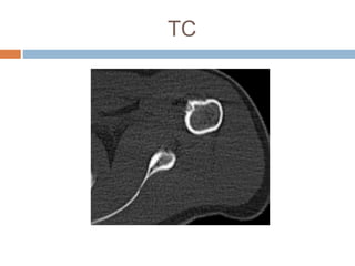 TC
 
