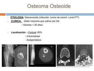 Osteoma Osteoide
 ETIOLOGIA: Desconocida (infección, tumor de crecim. Lento???)
 CLÍNICA: -Dolor nocturno que calma con AA.
- Varones < 30 años.
 Localización: - Cortical: 80%
- Intramedular
- Subperióstico
 