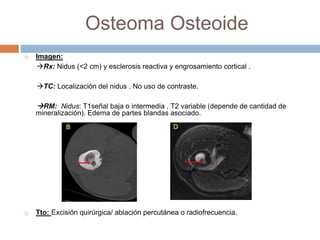 Osteoma Osteoide
 Imagen:
Rx: Nidus (<2 cm) y esclerosis reactiva y engrosamiento cortical .
TC: Localización del nidus . No uso de contraste.
RM: Nidus: T1señal baja o intermedia . T2 variable (depende de cantidad de
mineralización). Edema de partes blandas asociado.
 Tto: Excisión quirúrgica/ ablación percutánea o radiofrecuencia.
 