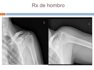 Rx de hombro
 