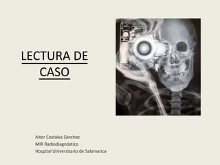 LECTURA DE
CASO
Aitor Costales Sánchez
MIR Radiodiagnóstico
Hospital Universitario de Salamanca
 