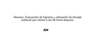 Neurocx: Evacuación de higroma y colocación de drenaje
subdural que retiran a las 48 horas despues.
RM
 