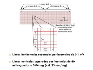 í“.QpÚ jQ z Ú
1 í“.QpÚ jQ N Ú 1
í“.QpÚ jQ z Ú
z (z K0(x’72z2 06
KUEFU
hWSWKM
l6 7)Q406’7q27H(
’x)Qxq0q506 20
’x4z/¿q9 pz ’x44
(z47/z’7¿q 20 (z6
e06QúÉ6 60 z)Q(7
0q 0( QzQ0( 20( l
20 (z6 xq2z6 w (x6
’zQ<5ú(x 673ú70q5
Q04x z ’xq57qúz’
pz ’x4470q50
Nú02z 4037654z2
Qx4 (z 206Qx(z47/
é2)bú g 4J¡E4 N
/z’7¿q K0q547’ú(¨ Líneas horizontales separadas por intervalos de 0,1 mV
¨ Líneas verticales separadas por intervalos de 40
milisegundos o 0.04 seg (vel. 25 mm/seg)
 