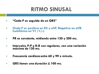 RITMO SINUSAL
§ “Cada P es seguida de un QRS”
§ Onda P es positiva en D2 y aVF. Negativa en aVR.
Isobifásico en V1 (+/-).
§ PR es constante, midiendo entre 120 y 200 ms.
§ Intervalos P-P o R-R son regulares, con una variación
máxima de 120 ms.
§ Frecuencia cardíaca entre 60 y 99 x minuto.
§ QRS tienen una duración ≤ 100 ms.
 