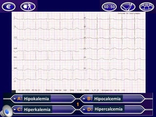 Hipokalemia
Hiperkalemia
Hipocalcemia
Hipercalcemia
 