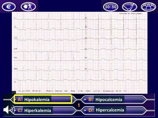Hipokalemia
Hiperkalemia
Hipocalcemia
Hipercalcemia
 