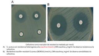 Cefoxitina como marcador de resistencia mediada por mecA.
A) S. aureus con resistencia heterogenea a la oxacilina (mecA+);CMI oxacilina 4 mg/ml. Se observa resistencia a la
cefoxitina.
B) Borderline oxacillin-resistant S.aureus (BORSA) (mecA-); CMI oxacilina4 mg/ml. Se observa sensibilidad a la
cefoxitina.
 