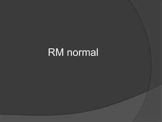 RM normal
 