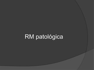 RM patológica
 