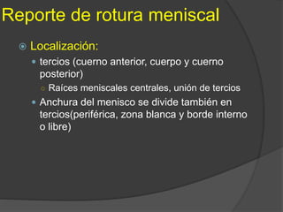 Reporte de rotura meniscal
 Localización:
 tercios (cuerno anterior, cuerpo y cuerno
posterior)
○ Raíces meniscales centrales, unión de tercios
 Anchura del menisco se divide también en
tercios(periférica, zona blanca y borde interno
o libre)
 