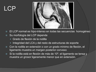 LCP
 El LCP normal es hipo-intenso en todas las secuencias homogéneo
 Su morfología del LCP depende
 Grado de flexión de la rodilla
 Integridad del LCA y del resto de estructuras de soporte
 Con la rodilla en extensión o con un grado mínimo de flexión, el
ligamento muestra un margen posterior convexo
 Si la rodilla está en flexión de más de 10º, el ligamento se tensa y
muestra un grosor ligeramente menor que en extensión.
 