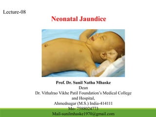 Lecture-08
Neonatal Jaundice
Prof. Dr. Sunil Natha Mhaske
Dean
Dr. Vithalrao Vikhe Patil Foundation’s Medical College
and Hospital,
Ahmednagar (M.S.) India-414111
Mo- 7588024773
Mail-sunilmhaske1970@gmail.com
 